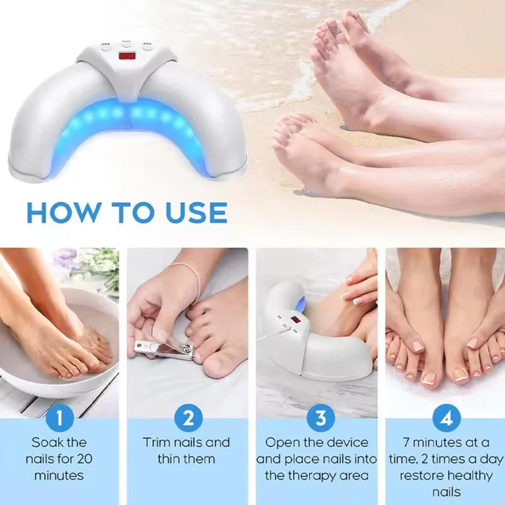 Nail Fungus Laser
