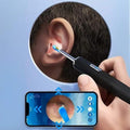 Ear Wax Removal Camera with LED Illumination and Rechargeable Handle, Wireless Viewing