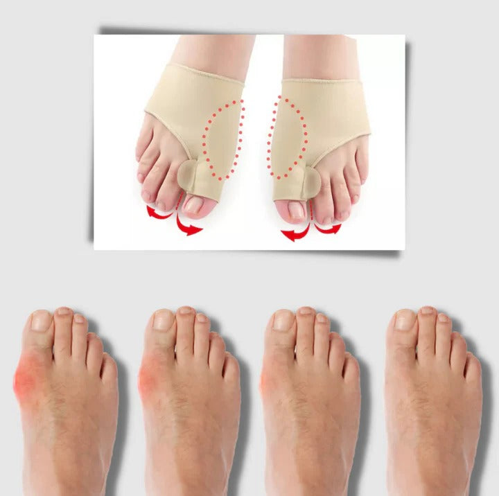 Gel bunion corrector