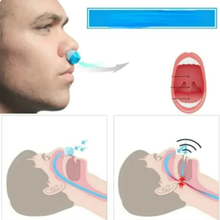 2-in-1 Anti Snore Device and Air Purifier Nose Clip