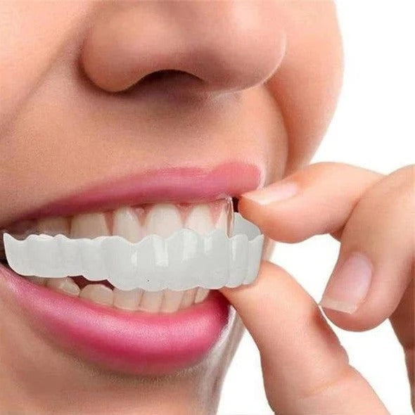 Removable Smile Veneers for Upper and Lower Teeth