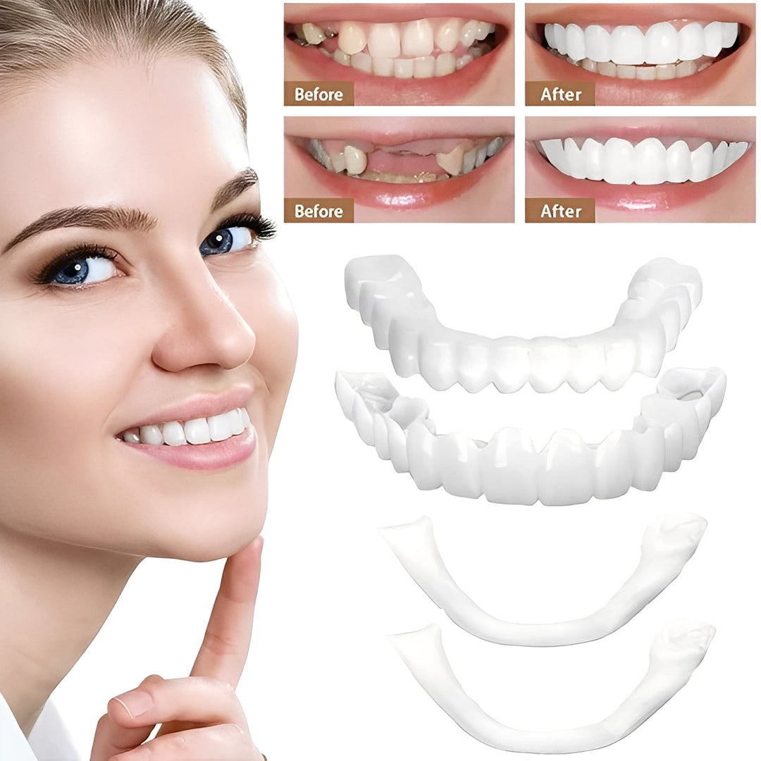 Cosmetic Veneers for Teeth Natural White Finish