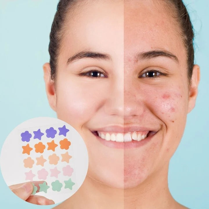 Havenholt Star Shaped Hydrocolloid Acne Patches