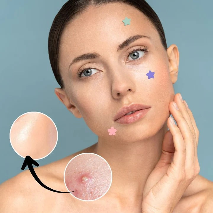 Havenholt Star Shaped Hydrocolloid Acne Patches